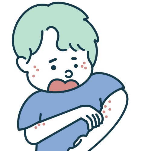 アトピー性皮膚炎